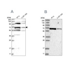 Western blot analysis using Anti-HOMEZ antibody HPA036316 (A) shows similar pattern to independent antibody HPA036317 (B).