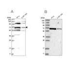 Western blot analysis using Anti-HOMEZ antibody HPA036316 (A) shows similar pattern to independent antibody HPA036317 (B).