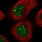 Immunofluorescent staining of human cell line A-431 shows localization to nucleus & nucleoli.