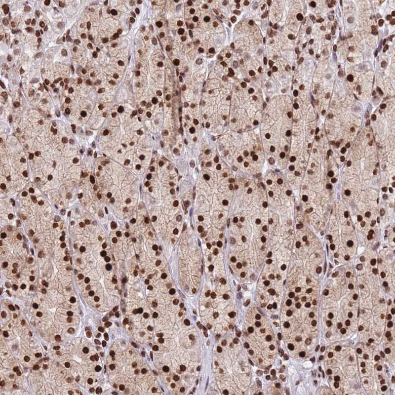Anti-AK9 Antibody