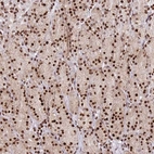Anti-AK9 Antibody