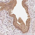 Anti-GUSB Antibody