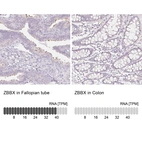 Anti-ZBBX Antibody