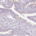 Immunohistochemical staining of human fallopian tube shows high expression.
