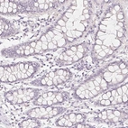 Immunohistochemical staining of human colon shows low expression as expected.