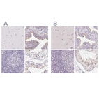 Immunohistochemical staining of human cerebral cortex, fallopian tube, lymph node and testis using Anti-ZBBX antibody HPA036328 (A) shows similar protein distribution across tissues to independent antibody HPA036327 (B).