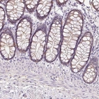 Immunohistochemical staining of human colon shows low expression as expected.