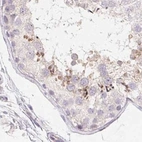 Immunohistochemical staining of human testis using Anti-ZBBX antibody HPA036327.