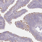 Immunohistochemical staining of human fallopian tube shows high expression.