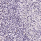 Immunohistochemical staining of human lymph node using Anti-ZBBX antibody HPA036327.