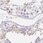 Immunohistochemical staining of human testis using Anti-ZBBX antibody HPA036328.