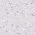 Immunohistochemical staining of human cerebral cortex using Anti-ZBBX antibody HPA036328.
