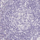 Immunohistochemical staining of human lymph node using Anti-ZBBX antibody HPA036328.