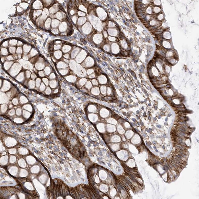 Anti-ANAPC1 Antibody