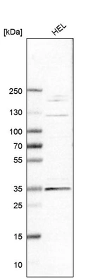 Western blot analysis in human cell line HEL.