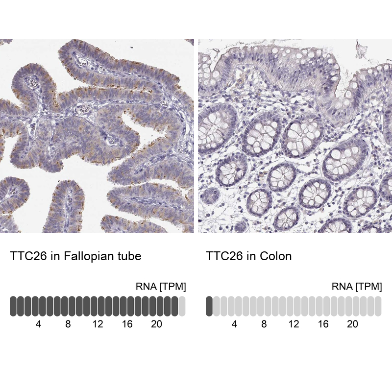 Anti-TTC26 Antibody