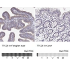 Anti-TTC26 Antibody
