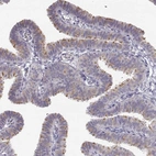 Immunohistochemical staining of human fallopian tube shows high expression.