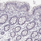 Immunohistochemical staining of human colon shows low expression as expected.