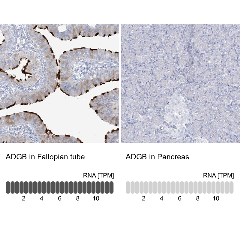 Anti-ADGB Antibody