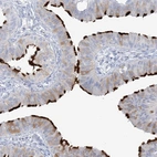 Immunohistochemical staining of human fallopian tube shows moderate to strong positivity in cilia in glandular cells.