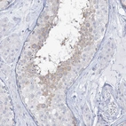 Immunohistochemical staining of human testis shows weak cytoplasmic positivity in cells in seminiferous ducts.
