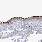 Immunohistochemical staining of human bronchus shows strong positivity in cilia in respiratory epithelial cells.