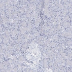 Immunohistochemical staining of human pancreas shows no positivity in exocrine glandular cells as expected.