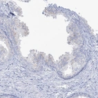Immunohistochemical staining of human prostate shows no positivity in glandular cells as expected.