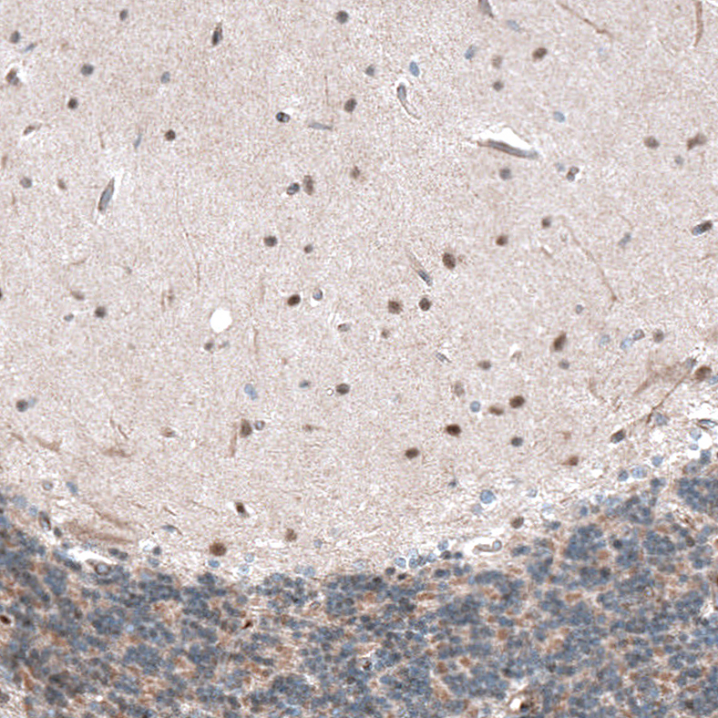 Anti-CAMTA1 Antibody