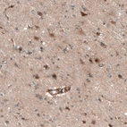 Immunohistochemical staining of human cerebral cortex shows weak to moderate nuclear and cytoplasmic positivity in neurons.