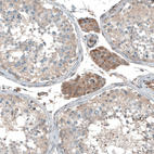 Immunohistochemical staining of human testis shows moderate cytoplasmic positivity in Leydig cells.
