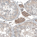 Immunohistochemical staining of human testis shows moderate cytoplasmic positivity in Leydig cells.