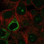 Anti-NOL9 Antibody