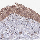 Anti-ITGB4 Antibody