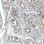 Immunohistochemical staining of human duodenum shows strong membranous positivity in glandular cells.