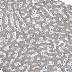 Immunohistochemical staining of human liver shows weak positivity in hepatocytes as expected.