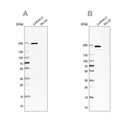 Western blot analysis using Anti-ITGB4 antibody HPA036349 (A) shows similar pattern to independent antibody HPA036348 (B).