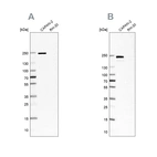 Western blot analysis using Anti-ITGB4 antibody HPA036349 (A) shows similar pattern to independent antibody HPA036348 (B).