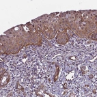 Immunohistochemical staining of human cervix, uterine shows moderate to strong membranous positivity in squamous epithelial cells.