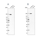 Western blot analysis using Anti-ITGB4 antibody HPA036348 (A) shows similar pattern to independent antibody HPA036349 (B).