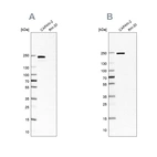 Western blot analysis using Anti-ITGB4 antibody HPA036348 (A) shows similar pattern to independent antibody HPA036349 (B).