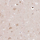 Immunohistochemical staining of human cerebral cortex shows moderate cytoplasmic positivity in neuronal cells.