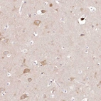 Immunohistochemical staining of human cerebral cortex shows moderate cytoplasmic positivity in neuronal cells.