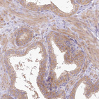 Immunohistochemical staining of human prostate shows moderate cytoplasmic/membranous positivity in glandular cells and smooth muscle cells.