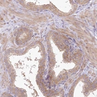 Immunohistochemical staining of human prostate shows moderate cytoplasmic/membranous positivity in glandular cells and smooth muscle cells.