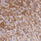 Immunohistochemical staining of human stomach shows moderate cytoplasmic positivity in glandular cells.