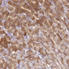 Immunohistochemical staining of human stomach shows moderate cytoplasmic positivity in glandular cells.