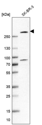 Western blot analysis in human cell line SK-BR-3.