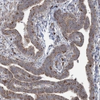 Anti-TRAF3IP2 Antibody